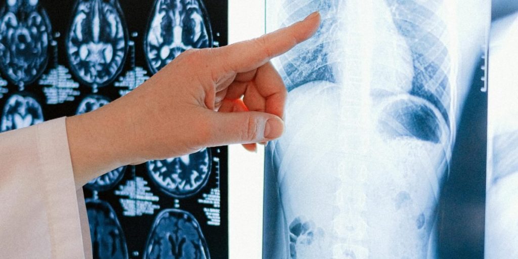 This article explains how 'doctor AI'—artificial intelligence applied to medical images—is transforming diagnostics in 2026 by speeding reads, reducing errors,...